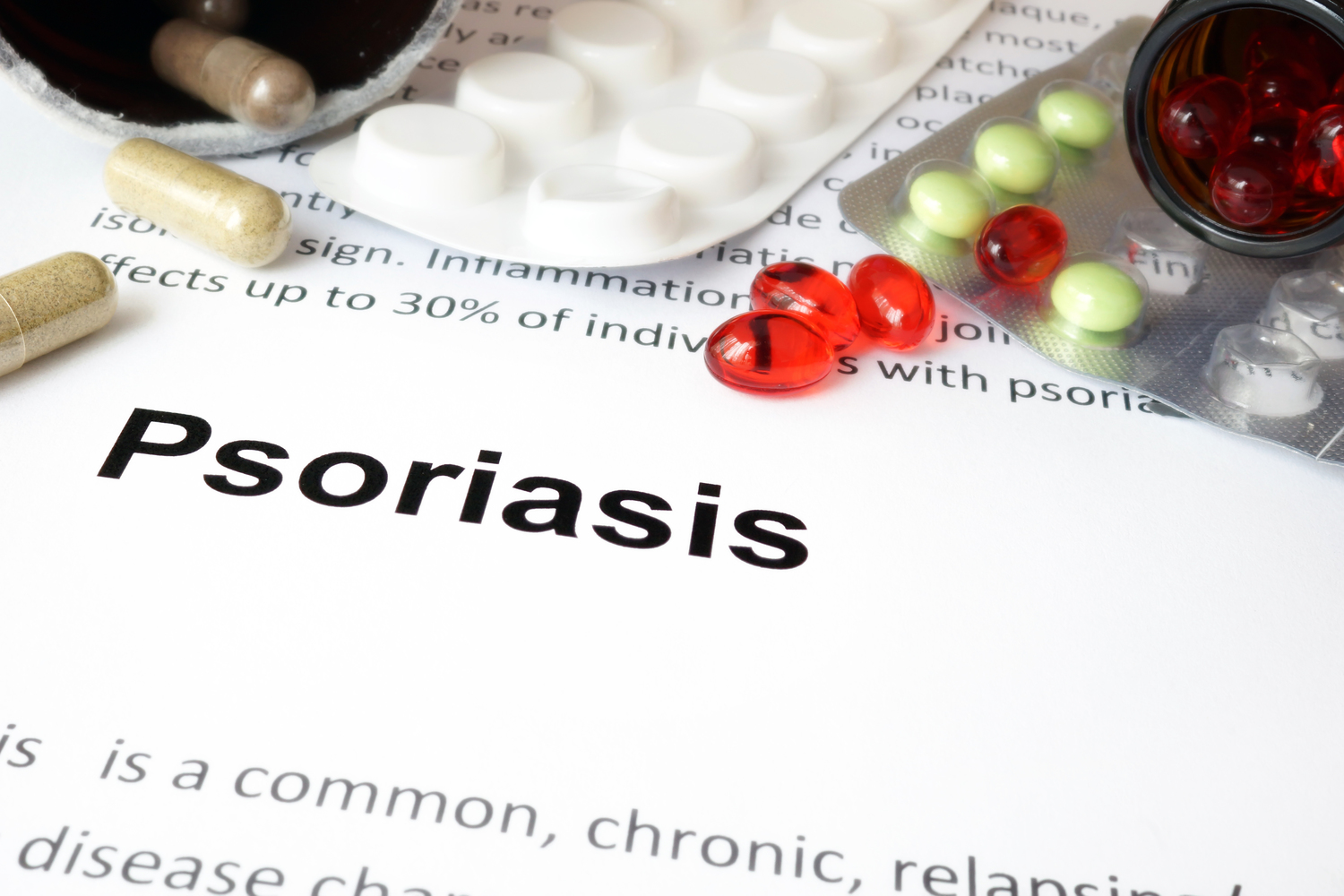 6 Causes of Psoriasis