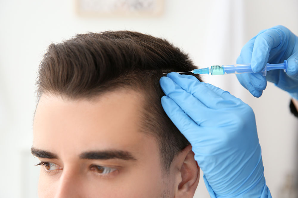 4 Best Hair Loss Treatments for Men